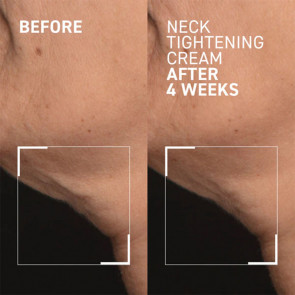 Dr.Brandt Needles No More Neck Tightening Cream Sıkılaştırıcı Boyun Kremi