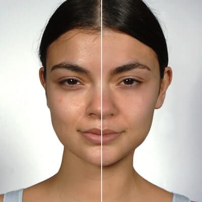 CİLDİNİZDEKİ PORLARDAN KURTULUN!