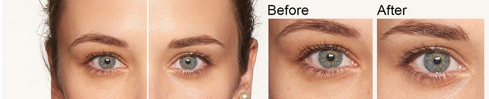 GÖZLERİN CANLANSIN